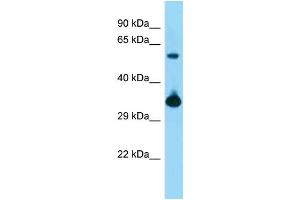 WB Suggested Anti-Bmi1 Antibody   Titration: 1. (BMI1 antibody  (Middle Region))