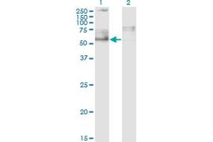 Western Blot analysis of IKZF5 expression in transfected 293T cell line by ZNFN1A5 monoclonal antibody (M01), clone 1B6. (IKZF5 antibody  (AA 2-100))