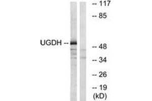 Western blot analysis of extracts from COLO cells, using UGDH Antibody. (UGDH antibody  (AA 391-440))