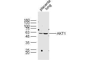 Western Blotting (WB) image for anti-AKT 1/2/3 (AA 401-479) antibody (ABIN725195)