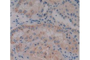 Used in DAB staining on fromalin fixed paraffin- embedded kidney tissue (BCAT1 antibody  (AA 174-386))