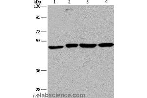 Western blot analysis of A431, HepG2, Raji and K562 cell, using CCR6 Polyclonal Antibody at dilution of 1:966 (CCR6 antibody)