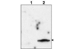 Western blot using  affinity purified anti-FIV Matrix Protein p15 to detect p15 in the culture supernatant of FIV-infected feline CrFK cells (lane 2, arrowhead). (Feline Immunodeficiency Virus Matrix (MA) (FIV p15) (Internal Region) antibody)