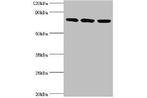 Western blot All lanes: DNA replication licensing factor MCM5 antibody at 3 μg/mL Lane 1: Hela whole cell lysate Lane 2: MCF-7 whole cell lysate Lane 2: Mouse thymus tissue Secondary Goat polyclonal to rabbit IgG at 1/10000 dilution Predicted band size: 82 kDa Observed band size: 82 kDa (MCM5 antibody  (AA 1-230))