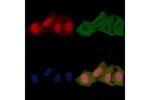 ABIN6256701 and ABIN6278650 staining Hela cells(24h of starvation treatment) by IF/ICC. (CSNK1A1 antibody  (pTyr294))