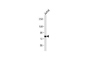 Anti-PKC theta Antibody (C-term) at 1:2000 dilution + Jurkat whole cell lysate Lysates/proteins at 20 μg per lane.
