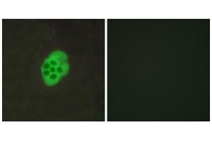 Immunofluorescence analysis of MCF-7 cells, using HTR4 antibody.