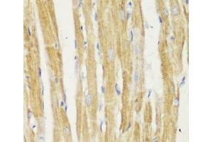 Immunohistochemistry (Paraffin-embedded Sections) (IHC (p)) image for anti-Mitochondrial Import Receptor Subunit TOM20 homolog (TOMM20) antibody (ABIN7259444)