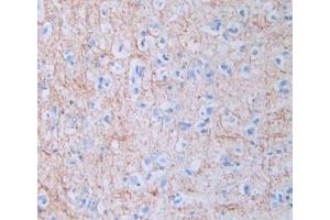 DAB staining on IHC-P; Samples: Human Brain Tissue (Amphiregulin antibody  (AA 20-100))
