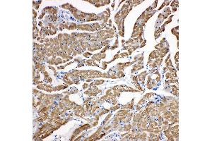 Anti-cardiac Troponin C antibody, IHC(P) IHC(P): Rat Cardiac Muscle Tissue (TNNC1 antibody  (N-Term))