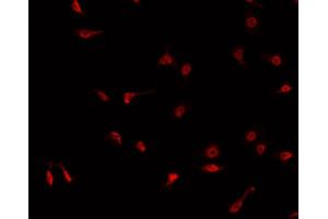 ABIN6268972 staining K-562 cells by IF/ICC. (Cyclin H antibody  (pThr315))