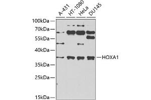Western blot analysis of extracts of various cell lines, using HOX antibody (ABIN6131766, ABIN6141930, ABIN6141931 and ABIN6222663) at 1:1000 dilution. (HOXA1 antibody  (AA 75-205))