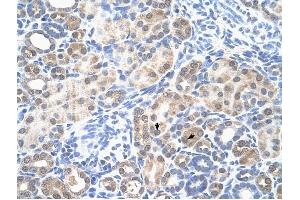 LOC342293 antibody was used for immunohistochemistry at a concentration of 4-8 ug/ml to stain Epithelial cells of renal tubule (arrows) in Human Kidney. (LOC342293 antibody  (N-Term))