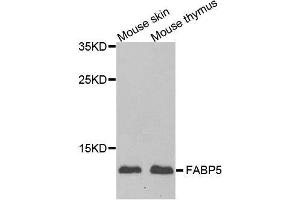 FABP5 antibody  (AA 1-135)