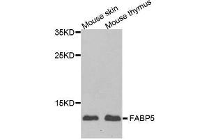 Western blot analysis of extracts of various cell lines, using FABP5 antibody. (FABP5 antibody  (AA 1-135))
