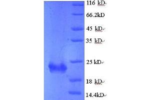 SDS-PAGE (SDS) image for Kruppel-Like Factor 6 (KLF6) (AA 27-207) protein (His tag) (ABIN4975150)