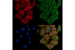 ABIN6260494 and ABIN6269220 staining Hela cells by IF/ICC.