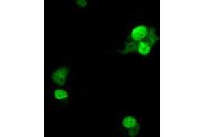 Anti-UBE2T mouse monoclonal antibody (ABIN2453760) immunofluorescent staining of COS7 cells transiently transfected by pCMV6-ENTRY UBE2T (RC200748). (Ube2t antibody)