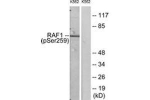 Western blot analysis of extracts from K562 cells, using C-RAF (Phospho-Ser259) Antibody. (RAF1 antibody  (AA 225-274))