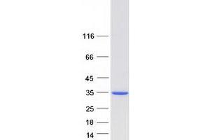 Validation with Western Blot (MLX Protein (Transcript Variant 1) (Myc-DYKDDDDK Tag))