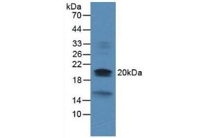 Dual Specificity Phosphatase 3 (DUSP3) (AA 2-185) anticorps