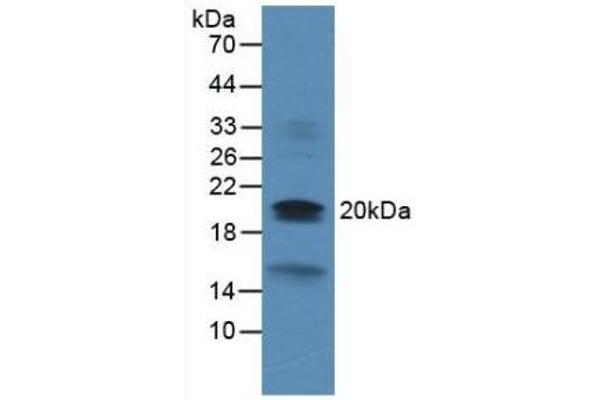 Dual Specificity Phosphatase 3 (DUSP3) (AA 2-185) anticorps