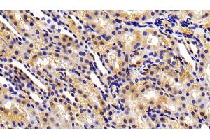Detection of MMP3 in Rat Kidney Tissue using Polyclonal Antibody to Matrix Metalloproteinase 3 (MMP3) (MMP3 antibody  (AA 278-450))