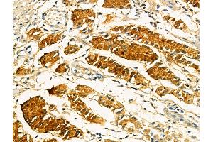ABIN7094413 and ABIN7098460 at 1/100 staining Human normal tissues adjacent to gastric cancer by IHC-P.