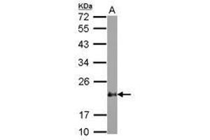 Image no. 1 for anti-Cysteine and Glycine-Rich Protein 2 (CSRP2) (AA 10-193) antibody (ABIN1497665) (CSRP2 antibody  (AA 10-193))