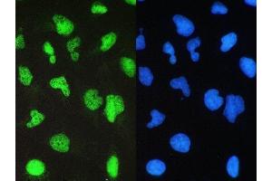IF analysis of BRG1 using anti-BRG1 antibody (ABIN5692863) BRG1 was detected in immunocytochemical section of U20S cell.