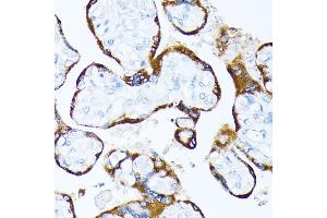 Immunohistochemistry of paraffin-embedded human placenta using Casein Kinase 1 alpha (Casein Kinase 1 alpha (CSNK1)) antibody (6225) at dilution of 1:100 (40x lens). (CSNK1A1 antibody  (AA 100-200))