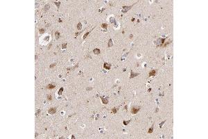 Immunohistochemical staining of human lateral ventricle with SSBP1 polyclonal antibody  shows strong cytoplasmic positivity in granular pattern in neuronal cells at 1:200-1:500 dilution. (SSBP1 antibody)