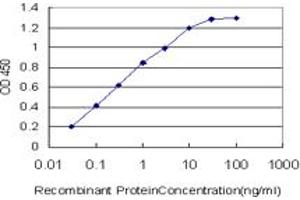 Detection limit for recombinant GST tagged CACNB2 is approximately 0. (CACNB2 antibody  (AA 213-301))