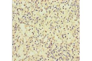 Immunohistochemistry of paraffin-embedded human spleen tissue using ABIN7146073 at dilution of 1:100 (CLEC4D antibody  (AA 39-215))