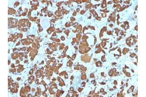 Formalin-fixed, paraffin-embedded human Pituitary stained with Growth Hormone Monoclonal Antibody (SPM106).