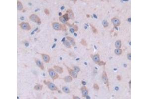 Immunohistochemistry (IHC) image for anti-Janus Kinase 2 (JAK2) (AA 564-809) antibody (ABIN1859523)