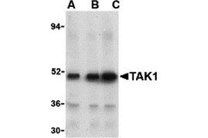 Western Blotting (WB) image for anti-Nuclear Receptor Subfamily 2, Group C, Member 2 (NR2C2) (N-Term) antibody (ABIN1031601) (TR4 antibody  (N-Term))