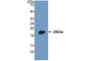 Detection of Recombinant DBI, Human using Polyclonal Antibody to Diazepam Binding Inhibitor (DBI) (Diazepam Binding Inhibitor antibody  (AA 1-104))