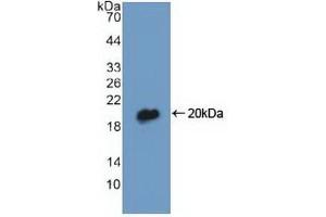Detection of Recombinant DBI, Human using Polyclonal Antibody to Diazepam Binding Inhibitor (DBI) (Diazepam Binding Inhibitor antibody  (AA 1-104))