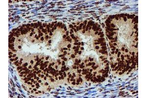 Image no. 1 for anti-Peptidyl Arginine Deiminase, Type IV (PADI4) antibody (ABIN1500017) (PAD4 antibody)