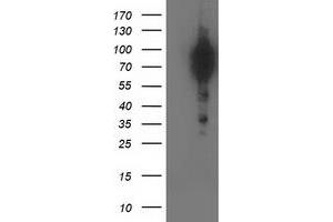 HEK293T cells were transfected with the pCMV6-ENTRY control (Left lane) or pCMV6-ENTRY BCAR1 (Right lane) cDNA for 48 hrs and lysed. (BCAR1 antibody)