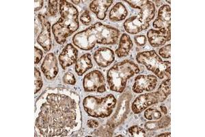 Immunohistochemical staining of human kidney with C9orf82 polyclonal antibody  shows distinct cytoplasmic positivity in cells in tubules. (Caspase Activity and Apoptosis Inhibitor 1 (CAAP1) antibody)