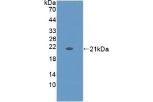 Detection of Recombinant KRT9, Human using Monoclonal Antibody to Cytokeratin 9 (CK9) (KRT9 antibody  (AA 315-456))