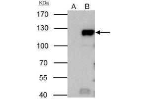Immunoprecipitation (IP) image for anti-Retinoblastoma 1 (RB1) (C-Term) antibody (ABIN2854790)