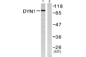 Western blot analysis of extracts from mouse brain, using Dynamin-1 (Ab-774) Antibody (#B0422). (Dynamin 1 antibody  (Ser774))