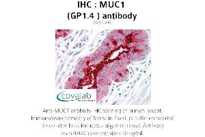 Image no. 1 for anti-Mucin 1 (MUC1) antibody (ABIN1724386) (MUC1 antibody)