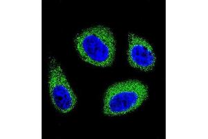 Immunofluorescence (IF) image for anti-7-Dehydrocholesterol Reductase (DHCR7) antibody (ABIN2996203) (DHCR7 antibody)