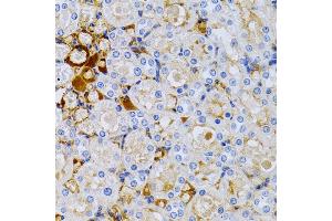 Immunohistochemistry (IHC) image for anti-Trefoil Factor 1 (TFF1) (AA 25-84), (pSer2) antibody (ABIN3015566)