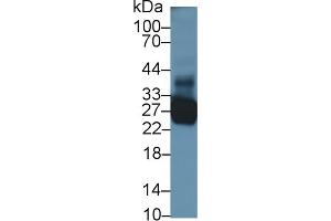 Detection of TNNI1 in Porcine Skeletal muscle lysate using Polyclonal Antibody to Troponin I Type 1, Slow Skeletal (TNNI1) (TNNI1 antibody  (AA 1-187))