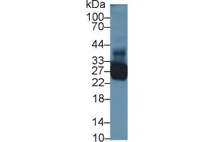 TNNI1 antibody  (AA 1-187)
